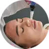 SkinPen Microneedling