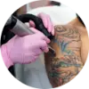 Tattoo Removal
