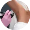 Laser Hair Removal