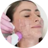 Thermage