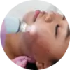 Potenza RF Microneedling